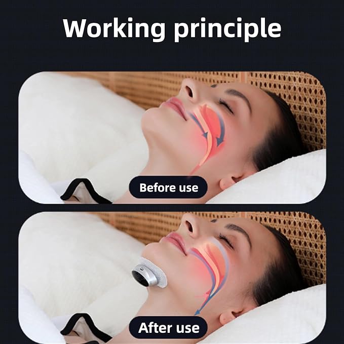 Anti-Snoring Chin Pulse for Quiet Nights